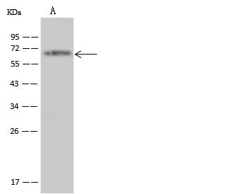 TRIM29 Antibody - Anti-TRIM29 rabbit polyclonal antibody at 1:500 dilution. Lane A: A431 Whole Cell Lysate. Lysates/proteins at 30 ug per lane. Secondary: Goat Anti-Rabbit IgG (H+L)/HRP at 1/10000 dilution. Developed using the ECL technique. Performed under reducing conditions. Predicted band size: 66 kDa. Observed band size: 66 kDa.
