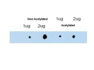 TRIM29 Antibody - Anti-ATDC (Ac-K116) Antibody - Western Blot. affinity purified anti-ATDC antibody shows reactivity by dot blot with acetylated and non-acetylated forms of the immunizing peptide. This antibody is predicted to recognize both acetylated (AcK116) and non-acetylated forms of ATDC protein. Personal communication, Z. Yuan, H Lee Moffitt Cancer Center and Research Institute.