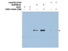 TRIM29 Antibody - Anti-ATDC (Ac-K116) Antibody - Western Blot. Western blot of affinity purified anti-ATDC (Ac-K116) antibody shows detection of a 66 kD band corresponding to over-expressed, acetylated lysine (K116) ATDC (arrowhead) in transfected 293T cells. No staining is noted for cells transfected with empty vector only. No staining is noted for cells transfected with an ATDC K116R mutant (K to R transversion lacks site for acetylation). In each instance, samples were prepared with and without TSA (1.3uM, 6 hr) which inhibits deacetylation. Personal communication, Z. Yuan, H Lee Moffitt Cancer Center and Research Institute.
