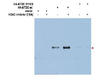 TRIM29 Antibody - Anti-ATDC (Ac-K116) Antibody - Western Blot. Western blot of affinity purified anti-ATDC (Ac-K116) antibody shows detection of a 66 kD band corresponding to over-expressed, acetylated lysine (K116) ATDC (arrowhead) in transfected 293T cells. No staining is noted for cells transfected with empty vector only. No staining is noted for cells transfected with an ATDC K116R mutant (K to R transversion lacks site for acetylation). In each instance, samples were prepared with and without TSA (1.3uM, 6 hr) which inhibits deacetylation. Personal communication, Z. Yuan, H Lee Moffitt Cancer Center and Research Institute.