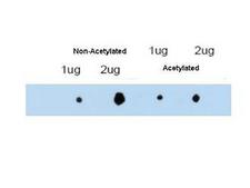 TRIM29 Antibody - Affinity purified anti-ATDC antibody shows reactivity by dot blot with acetylated and non-acetylated forms of the immunizing peptide. This antibody is predicted to recognize both acetylated (AcK116) and non-acetylated forms of ATDC protein.