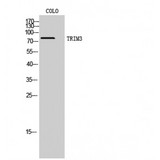 TRIM3 Antibody - Western blot of TRIM3 antibody