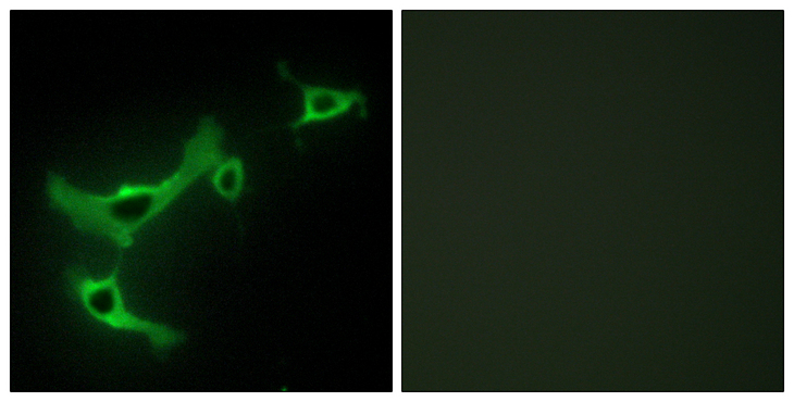 TRIM3 Antibody - Immunofluorescence analysis of NIH/3T3 cells, using TRIM3 Antibody. The picture on the right is blocked with the synthesized peptide.