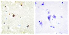 TRIM3 Antibody - Immunohistochemistry analysis of paraffin-embedded human brain tissue, using TRIM3 Antibody. The picture on the right is blocked with the synthesized peptide.