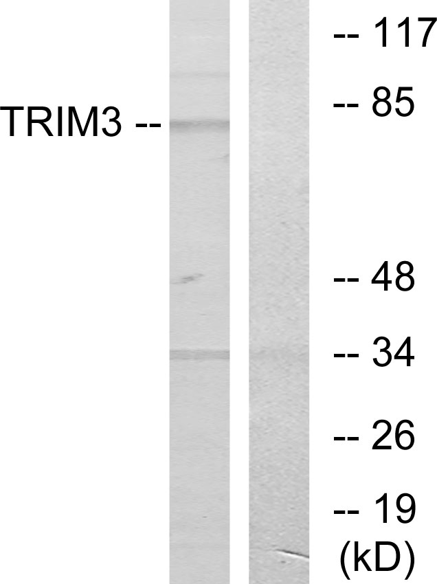 TRIM3 Antibody - Western blot analysis of lysates from COLO cells, using TRIM3 Antibody. The lane on the right is blocked with the synthesized peptide.