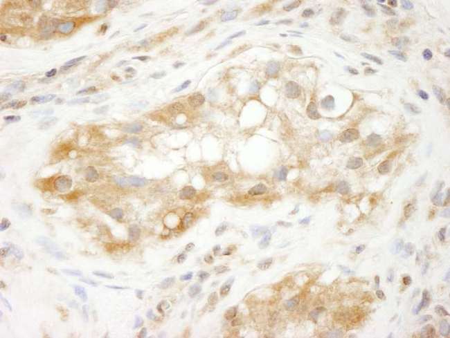 TRIM3 Antibody - FFPE section of human testis.  Rabbit anti-TRIM3/BERP IHC Antibody, Affinity Purified used at a dilution of 1:250.
