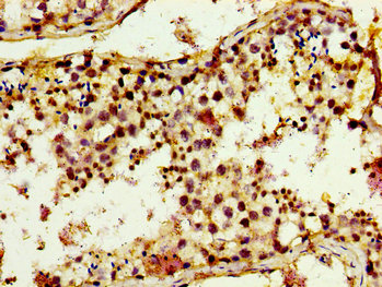 TRIM3 Antibody - Immunohistochemistry image of paraffin-embedded human testis tissue at a dilution of 1:100