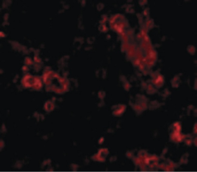 Trim30 Antibody - Immunofluorescence of TRIM30 in Human Ovary cells with TRIM30 antibody at 20 ug/ml.