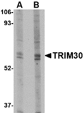Trim30 Antibody - Western blot of TRIM30 in mouse heart tissue lysate with TRIM30 antibody at (A) 1 and (B) 2 ug/ml.