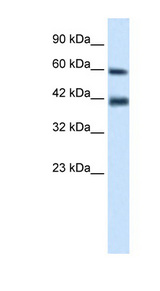TRIM31 / RNF Antibody - TRIM31 antibody Western blot of Jurkat lysate. This image was taken for the unconjugated form of this product. Other forms have not been tested.