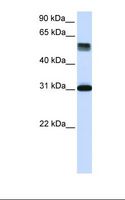 TRIM31 / RNF Antibody - Fetal lung lysate. Antibody concentration: 1.0 ug/ml. Gel concentration: 12%.  This image was taken for the unconjugated form of this product. Other forms have not been tested.