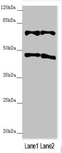 TRIM31 / RNF Antibody - Western blot All Lanes:TRIM31 antibody at 4.98 ug/ml Lane 1: HepG-2 whole cell lysate Lane 2: Hela whole cell lysate Secondary Goat polyclonal to rabbit IgG at 1/10000 dilution Predicted band size: 49,31 kDa Observed band size: 48,70 kDa