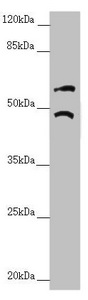 TRIM31 / RNF Antibody - Western blot All Lanes:TRIM31 antibody at 6.18 ug/ml+ A549 whole cell lysate Secondary Goat polyclonal to rabbit IgG at 1/10000 dilution Predicted band size: 49,31 kDa Observed band size: 48,57 kDa