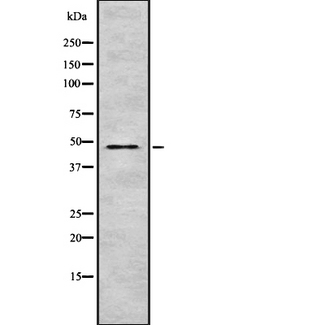 TRIM31 / RNF Antibody - Western blot analysis of TRI31 expression in HEK293 cells. The lane on the left is treated with the antigen-specific peptide.