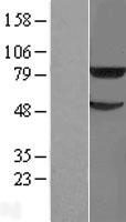 TRIM31 / RNF Protein - Western validation with an anti-DDK antibody * L: Control HEK293 lysate R: Over-expression lysate