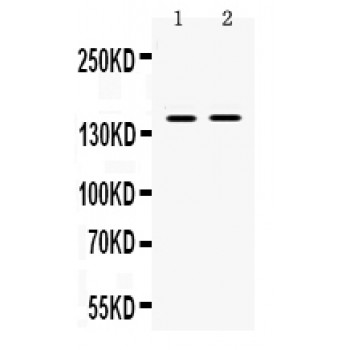 TRIM33 / TIF1-Gamma Antibody - TIF1 gamma antibody Western blot. All lanes: Anti TIF1 gamma at 0.5 ug/ml. Lane 1: 22RV1 Whole Cell Lysate at 40 ug. Lane 2: SW620 Whole Cell Lysate at 40 ug. Predicted band size: 150 kD. Observed band size: 150 kD.