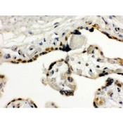 TRIM33 / TIF1-Gamma Antibody - TIF1 gamma antibody IHC-paraffin. IHC(P): Human Placenta Tissue.