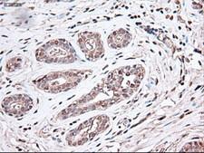 TRIM33 / TIF1-Gamma Antibody - IHC of paraffin-embedded breast using anti-Trim33 mouse monoclonal antibody.