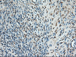 TRIM33 / TIF1-Gamma Antibody - IHC of paraffin-embedded ovary using anti-Trim33 mouse monoclonal antibody.