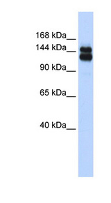 TRIM33 / TIF1-Gamma Antibody - TRIM33 / TIF1-Gamma antibody Western blot of HeLa lysate. This image was taken for the unconjugated form of this product. Other forms have not been tested.