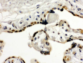 TRIM33 / TIF1-Gamma Antibody