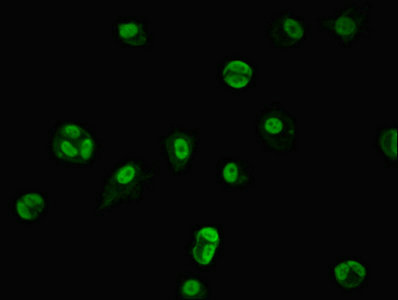 TRIM33 / TIF1-Gamma Antibody - Immunofluorescent analysis of MCF-7 cells using TRIM33 Antibody at dilution of 1:100 and Alexa Fluor 488-congugated AffiniPure Goat Anti-Rabbit IgG(H+L)