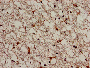 TRIM33 / TIF1-Gamma Antibody - Immunohistochemistry analysis of human brain tissue using TRIM33 Antibody at dilution of 1:100