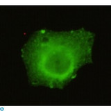 TRIM33 / TIF1-Gamma Antibody - Immunofluorescence (IF) analysis of HeLa cells using TIF1gamma Monoclonal Antibody.