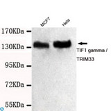 TRIM33 / TIF1-Gamma Antibody - Western blot detection of TIF1 gamma / TRIM33 in MCF7 and HeLa cell lysates using TIF1 gamma / TRIM33 mouse mAb (1:1000 diluted). Predicted band size: 120KDa. Observed band size: 140KDa.