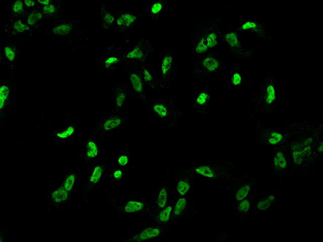 TRIM33 / TIF1-Gamma Antibody - Immunofluorescence staining of TRIM33 in U251MG cells. Cells were fixed with 4% PFA, permeabilzed with 0.1% Triton X-100 in PBS, blocked with 10% serum, and incubated with rabbit anti-Human TRIM33 polyclonal antibody (dilution ratio 1:200) at 4°C overnight. Then cells were stained with the Alexa Fluor 488-conjugated Goat Anti-rabbit IgG secondary antibody (green).