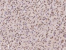 TRIM33 / TIF1-Gamma Antibody - Immunochemical staining of human TRIM33 in human adrenal gland with rabbit polyclonal antibody at 1:2000 dilution, formalin-fixed paraffin embedded sections.
