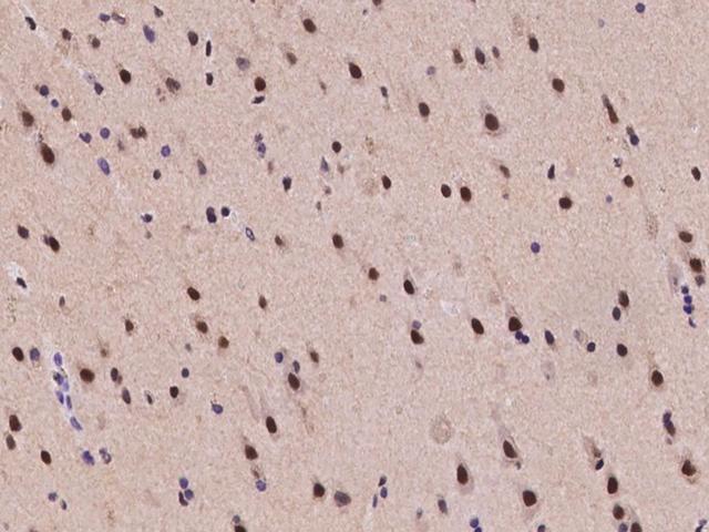 TRIM33 / TIF1-Gamma Antibody - Immunochemical staining of human TRIM33 in human brain with rabbit polyclonal antibody at 1:2000 dilution, formalin-fixed paraffin embedded sections.