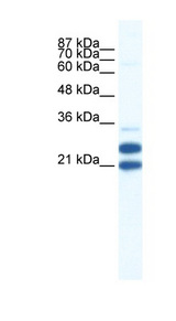 TRIM34 / RNF21 Antibody - TRIM34 / RNF21 antibody Western blot of Jurkat lysate. This image was taken for the unconjugated form of this product. Other forms have not been tested.