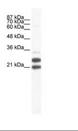 TRIM34 / RNF21 Antibody - Jurkat Cell Lysate.  This image was taken for the unconjugated form of this product. Other forms have not been tested.