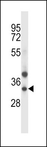 TRIM34 / RNF21 Antibody - TRIM34 Antibody western blot of NCI-H292 cell line lysates (35 ug/lane). The TRIM34 antibody detected the TRIM34 protein (arrow).
