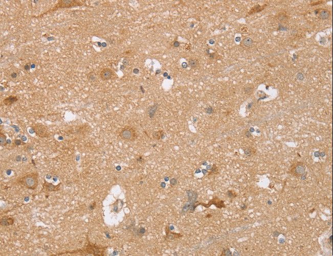 TRIM34 / RNF21 Antibody - Immunohistochemistry of paraffin-embedded Human brain using TRIM34 Polyclonal Antibody at dilution of 1:30.