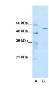 TRIM35 Antibody - TRIM35 antibody Western blot of HepG2 cell lysate. This image was taken for the unconjugated form of this product. Other forms have not been tested.