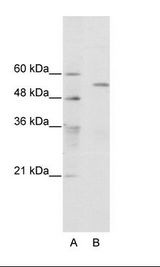 TRIM35 Antibody - A: Marker, B: HepG2 Cell Lysate.  This image was taken for the unconjugated form of this product. Other forms have not been tested.