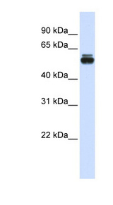 TRIM35 Antibody - TRIM35 antibody Western blot of Fetal Muscle lysate. This image was taken for the unconjugated form of this product. Other forms have not been tested.