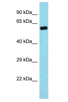 TRIM35 Antibody - TRIM35 antibody Western Blot of Mouse Kidney. Antibody dilution: 1 ug/ml.  This image was taken for the unconjugated form of this product. Other forms have not been tested.