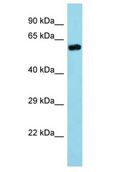 TRIM35 Antibody - TRIM35 antibody Western Blot of Mouse Kidney. Antibody dilution: 1 ug/ml.  This image was taken for the unconjugated form of this product. Other forms have not been tested.