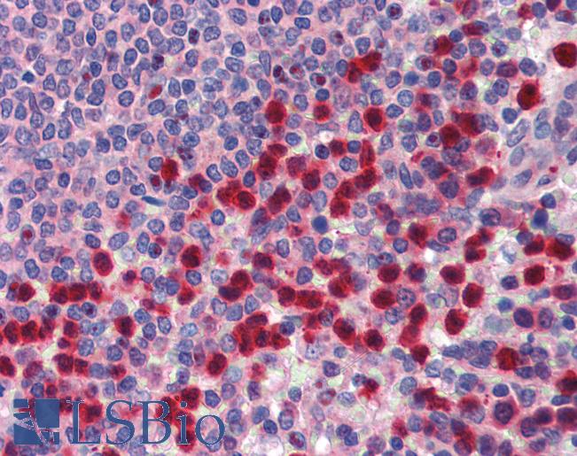 TRIM35 Antibody - Anti-TRIM35 antibody IHC of human spleen. Immunohistochemistry of formalin-fixed, paraffin-embedded tissue after heat-induced antigen retrieval. Antibody concentration 5 ug/ml.  This image was taken for the unconjugated form of this product. Other forms have not been tested.