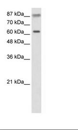 TRIM35 Antibody - HepG2 Cell Lysate.  This image was taken for the unconjugated form of this product. Other forms have not been tested.