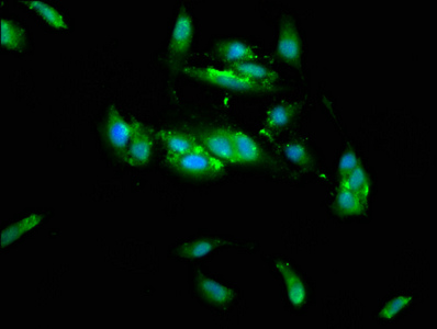 TRIM35 Antibody - Immunofluorescence staining of Hela cells with TRIM35 Antibody at 1:133, counter-stained with DAPI. The cells were fixed in 4% formaldehyde, permeabilized using 0.2% Triton X-100 and blocked in 10% normal Goat Serum. The cells were then incubated with the antibody overnight at 4°C. The secondary antibody was Alexa Fluor 488-congugated AffiniPure Goat Anti-Rabbit IgG(H+L).