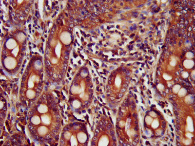 TRIM35 Antibody - IHC image of TRIM35 Antibody diluted at 1:400 and staining in paraffin-embedded human small intestine tissue performed on a Leica BondTM system. After dewaxing and hydration, antigen retrieval was mediated by high pressure in a citrate buffer (pH 6.0). Section was blocked with 10% normal goat serum 30min at RT. Then primary antibody (1% BSA) was incubated at 4°C overnight. The primary is detected by a biotinylated secondary antibody and visualized using an HRP conjugated SP system.