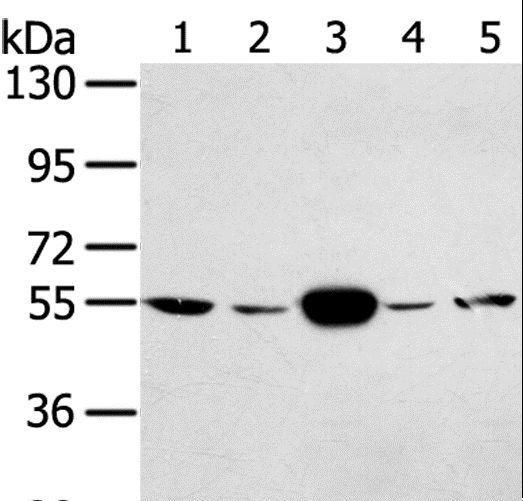 TRIM35 Antibody - Western blot analysis of HeLa and K562 cell, human fetal muscle tissue, A375 and hepg2 cell, using TRIM35 Polyclonal Antibody at dilution of 1:400.