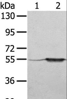 TRIM35 Antibody - Western blot analysis of A375 cell and human fetal muscle tissue, using TRIM35 Polyclonal Antibody at dilution of 1:550.
