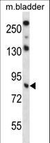 TRIM36 Antibody - TRIM36 Antibody western blot of mouse bladder tissue lysates (35 ug/lane). The TRIM36 antibody detected the TRIM36 protein (arrow).