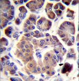 TRIM36 Antibody - TRIM36 Antibody immunohistochemistry of formalin-fixed and paraffin-embedded human pancreas tissue followed by peroxidase-conjugated secondary antibody and DAB staining.