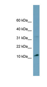 TRIM36 Antibody - TRIM36 antibody Western blot of OVCAR-3 cell lysate. This image was taken for the unconjugated form of this product. Other forms have not been tested.